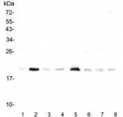 Western blot testing of rat 1) heart, 2) lung, 3) stomach, 4) kidney and mouse 5) heart, 6) lung, 7) stomach and 8) kidney lysate with RAP1A antibody. Expected molecular weight ~21 kDa.