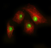 Immunofluorescent staining of FFPE human A549 cells with RAC1 antibody (green) and Beta Tubulin mAb (red). HIER: steam section in pH6 citrate buffer for 20 min.