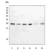 Western blot testing of 1) human A431, 2) human HaCaT, 3) human MCF7, 4) human PC-3, 5) rat small intestine and 6) mouse small intestine tissue lysate with RAC1 antibody. Expected molecular weight ~22 kDa.