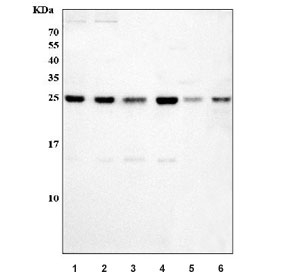 Western blot testing of 1) human U-87 MG, 2) human HeLa, 3) human ThP-1, 4) human RT4, 5) rat brain and 6) mouse brain tissue lysate with SNRPN antibody. Predicted molecular weight ~25 kDa.