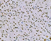 IHC staining of FFPE mouse brain tissue with SNRPN antibody. HIER: boil tissue sections in pH8 EDTA for 20 min and allow to cool before testing.