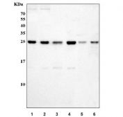 Western blot testing of 1) human U-87 MG, 2) human HeLa, 3) human ThP-1, 4) human RT4, 5) rat brain and 6) mouse brain tissue lysate with SNRPN antibody. Predicted molecular weight ~25 kDa.