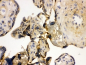 IHC testing of frozen human placenta with YB1 antibody.