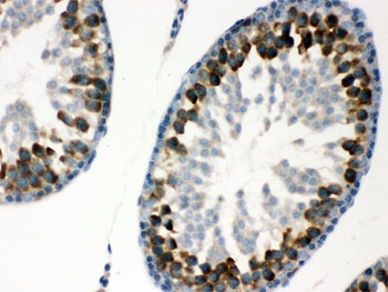IHC testing of FFPE rat testis with YB1 antibody. HIER: Boil the paraffin sections in pH 6, 10mM citrate buffer for 20 minutes and allow to cool prior to staining.