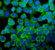 Immunofluorescent staining of FFPE human A431 cells with YB1 antibody (green) and DAPI nuclear stain (blue). HIER: steam section in pH6 citrate buffer for 20 min.