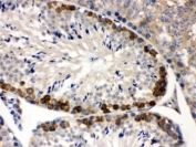 IHC testing of FFPE mouse testis with YB1 antibody. HIER: Boil the paraffin sections in pH 6, 10mM citrate buffer for 20 minutes and allow to cool prior to staining.
