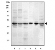 Western blot testing of 1) human HeLa, 2) human MCF7, 3) human Jurkat, 4) human T-47D, 5) rat spleen and 6) mouse RAW264.7 cell lysate with YB1 antibody. Expected molecular weight: 39~50 kDa depending on glycosylation level.