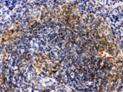 IHC testing of FFPE mouse spleen with Actin antibody. HIER: Boil the paraffin sections in pH 6, 10mM citrate buffer for 20 minutes and allow to cool prior to staining.
