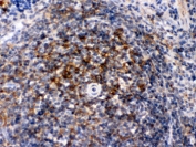 IHC testing of FFPE rat spleen with Actin antibody. HIER: Boil the paraffin sections in pH 6, 10mM citrate buffer for 20 minutes and allow to cool prior to staining.