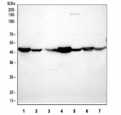 Western blot testing of 1) rat liver, 2) rat kidney, 3) mouse spleen, human 4) HeLa, 5) COLO320, 6) SMMC and 7) A549 lysate with anti-Actin antibody. Expected molecular weight: 42-45 kDa.