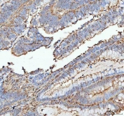 IHC testing of FFPE rat speen with anti-Actin antibody. HIER: Boil the paraffin sections in pH 6, 10mM citrate buffer for 20 minutes and allow to cool prior to staining.