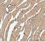 IHC staining of FFPE mouse heart tissue with anti-Actin antibody. HIER: boil tissue sections in pH8 EDTA for 20 min and allow to cool before testing.