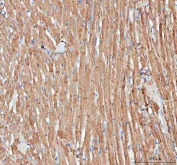 IHC staining of FFPE rat heart tissue with anti-Actin antibody. HIER: boil tissue sections in pH8 EDTA for 20 min and allow to cool before testing.