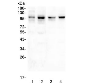 Western blot testing of 1) rat skeletal muscle, 2) rat heart, 3) human HeLa, 4) human A549 and 5) human 293 lysate with PSD95 antibody. Predicted molecular weight ~80 kDa but routinely observed at 90~95 kDa.~