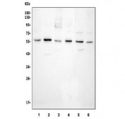 Western blot testing of human 1) placenta, 2) U937, 3) PC3, 4) ThP-1, 5) MCF7 and 6) HeLa cell lysate with Cyclin A1 antibody. Predicted molecular weight 50~55 kDa.