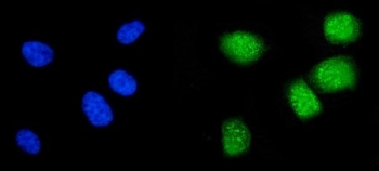 Immunofluorescent staining of FFPE human PC-3 cells with Cyclin A1 antibody (green) and DAPI nuclear stain (blue). HIER: steam section in pH6 citrate buffer for 20 min.~