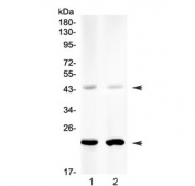 Western blot testing of human 1) SMMC-7721 and 2) A549 cell lysate (50ug/lane) with NGAL antibody at 0.5ug/ml. Predicted/observed molecular weigth: 22-25 kDa (monomer), ~45 kDa (homodimer). Higher amounts of lysate/lane, a greater concentration of primary antibody or longer exposure times may be required to visualize the homodimer.