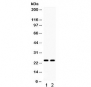 Western blot testing of human 1) A549 and 2) SMMC cell lysate with NGAL antibody at 0.5ug/ml. Predicted/observed molecular weigth: 22-25 kDa (monomer).