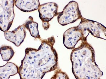 IHC testing of human placenta with HSD11B2 antibody. HIER: Boil the paraffin sections in pH 6, 10mM citrate buffer for 20 minutes and allow to cool prior to staining.
