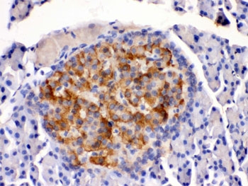IHC testing of rat pancreas with HSD11B2 antibody. HIER: Boil the paraffin sections in pH 6, 10mM citrate buffer for 20 minutes and allow to cool prior to staining.