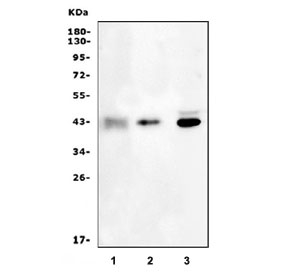 Western blot testing of 1) rat kidney, 2) mouse kidney and 3) human placenta lysate with HSD11B2 antibody. Expected/observed molecular weight ~44 kDa.