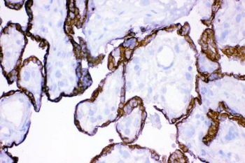 IHC staining of frozen human placental tissue with HSD11B2 antibody.