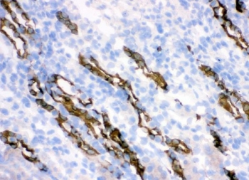 IHC staining of frozen mouse kidney tissue with HSD11B2 antibody.