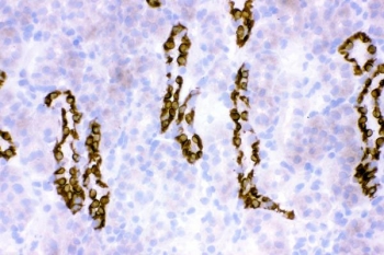 IHC staining of frozen rat kidney tissue with HSD11B2 antibody.
