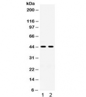 Western blot testing of 1) rat kidney and 2) human placenta lysate with HSD11B2 antibody. Expected/observed molecular weight ~44 kDa.