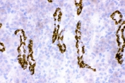 IHC staining of frozen rat kidney tissue with HSD11B2 antibody.