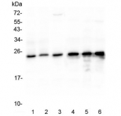 Western blot testing of human 1) Jurkat, 2) A431, 3) HL-60, 4) CCRF-CEM, 5) 293T and 6) SW620 lysate with mtTFA antibody at 0.5ug/ml. Expected molecular weight 24~29 kDa.