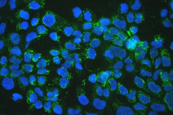 IF/ICC staining of FFPE human A431 cells with mtTFA antibody (green) at 2ug/ml and DAPI nuclear stain (blue). HIER: steam section in pH6 citrate buffer for 20 min.