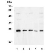 Western blot testing of human 1) Caco-2, 2) SW620, 3) PANC-1, 4) rat brain and 5) mouse brain lysate with mtTFA antibody. Expected molecular weight 24~29 kDa.