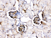 IHC testing of FFPE mouse kidney with Apolipoprotein A I antibody. HIER: Boil the paraffin sections in pH 6, 10mM citrate buffer for 20 minutes and allow to cool prior to staining.
