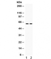 Western blot testing of human 1) HeLa and 2) HUT lysate with Rel-B antibody. Expected/observed molecular weight: 62-70 kDa.