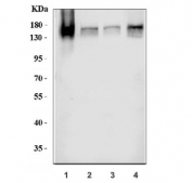 Western blot testing of 1) human A431, 2) human A549, 3) U-87 MG and 4) mouse liver tissue lysate with EGFR antibody. Expected molecular weight: 134-180 kDa depending on glycosylation level.