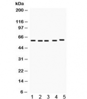 Western blot testing of 1) rat liver, 2) mouse liver, 3) rat kidney, 4) mouse kidney, 5) human SMMC lysate with FMO1 antibody. Predicted/observed molecular weight ~60 kDa.