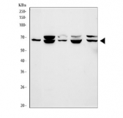 Western blot testing of 1) human HCCT, 2) human HepG2, 3) human HUH7, 4) rat liver and 5) mouse liver tissue lysate with FMO1 antibody. Predicted molecular weight ~60 kDa.