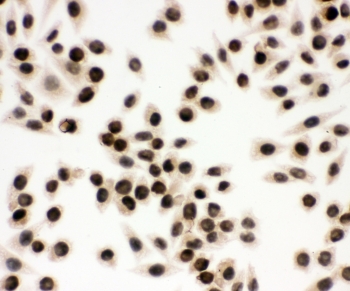 ICC staining of FFPE human SMMC-7721 cells with EWSR1 antibody at 1ug/ml. HIER: Boil the paraffin sections in pH 6, 10mM citrate buffer for 20 minutes and allow to cool prior to staining.