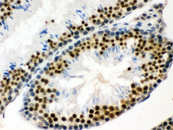 IHC testing of FFPE mouse testis with EWSR1 antibody. HIER: Boil the paraffin sections in pH 6, 10mM citrate buffer for 20 minutes and allow to cool prior to staining.