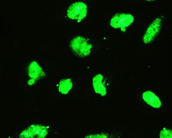 Immunofluorescent staining of FFPE human U-2 OS cells with EWSR1 antibody (green) at 2ug/ml. HIER: steam section in pH6 citrate buffer for 20 min.