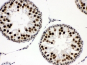IHC testing of FFPE rat testis with EWSR1 antibody. HIER: Boil the paraffin sections in pH 6, 10mM citrate buffer for 20 minutes and allow to cool prior to staining.