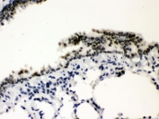 IHC testing of FFPE rat lung wtih SP3 antibody. HIER: Boil the paraffin sections in pH 6, 10mM citrate buffer for 20 minutes and allow to cool prior to staining.