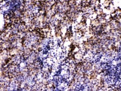 IHC testing of FFPE mouse lymph node with PAX2 antibody. HIER: Boil the paraffin sections in pH 6, 10mM citrate buffer for 20 minutes and allow to cool prior to staining.