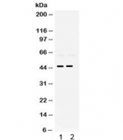 Western blot testing of 1) rat brain and 2) rat lung lysate with PAX2 antibody. Expected/observed molecular weight ~45 kDa.