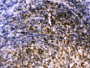 IHC testing of FFPE rat lymph node with PAX2 antibody. HIER: Boil the paraffin sections in pH 6, 10mM citrate buffer for 20 minutes and allow to cool prior to staining.