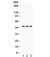 Western blot testing of 1) rat liver, 2) mouse liver and 3) human HepG2 lysate with HHEX antibody. Routinely observed at 35~37 kDa (Ref 1), observed here at ~47 kDa.