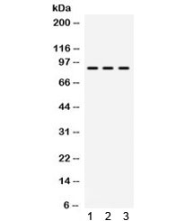 Western blot testing of human 1) HeLa, 2) HUT and 3) SW620 cell lysate with TAP1 antibody. Expected/observed molecular weight ~87 kDa.~