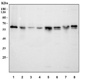 Western blot testing of 1) human SH-SY5Y, 2) human RT4, 3) human MCF7, 4) human K562, 5) rat pancreas, 6) rat brain, 7) mouse pancreas and 8) mouse brain tissue lysate with ICA1 antibody. Predicted molecular weight ~55 kDa but can also be observed at 64-69 kDa.