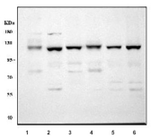 Western blot testing of 1) rat brain, 2) rat C6, 3) mouse lung, 4) mouse brain, 5) mouse RAW264.7 and 6) mouse NIH 3T3 cell lysate with FAK antibody. FAK has numerous isoforms and is routinely observed in western blot between 80~125 kDa.